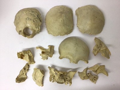 Lot 2 - An Edwardian human skull