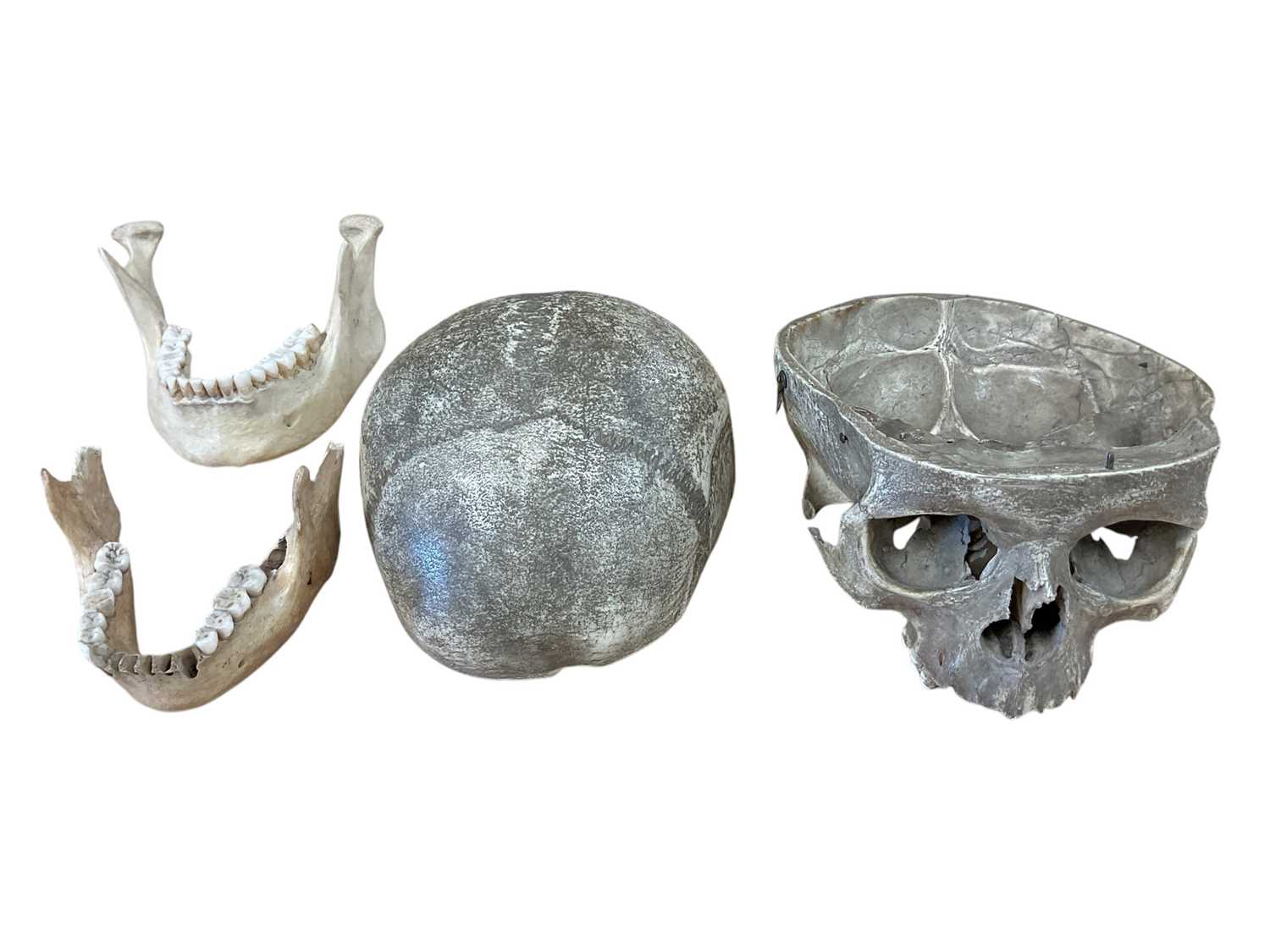 Lot 2499 - 19th century human skull prepared for medical education purposes and other human bone remains with two cardboard containers retailed by Henry Kimpton 82 High Holborn, London