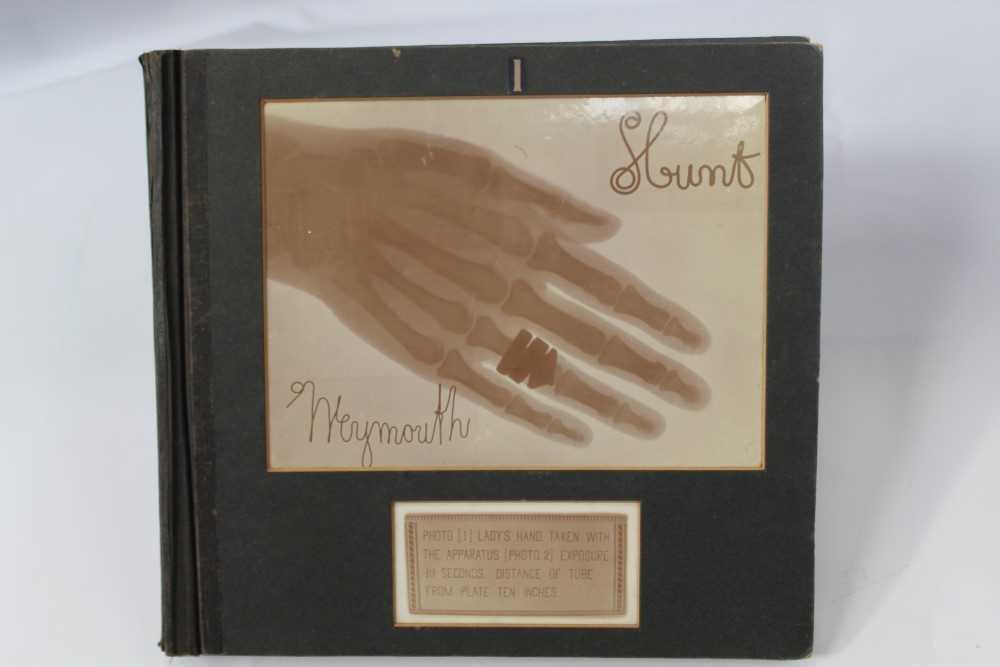 Lot 2547 - Unusual group of earty X-ray photographs by S. Hunt Weymouth